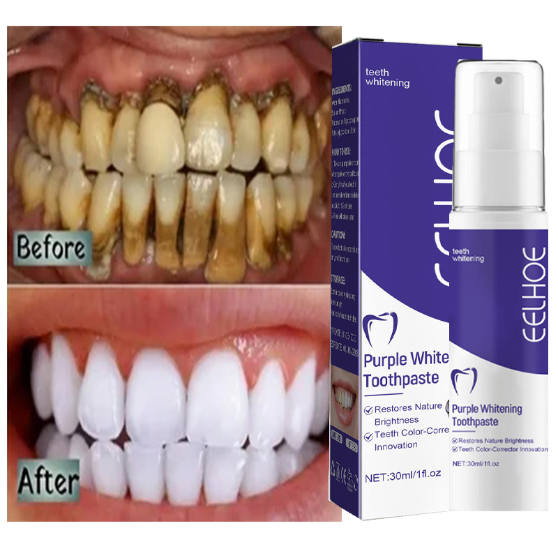 Teeth Whitening In Korea - 1 шт. зубная паста для Очищающая,