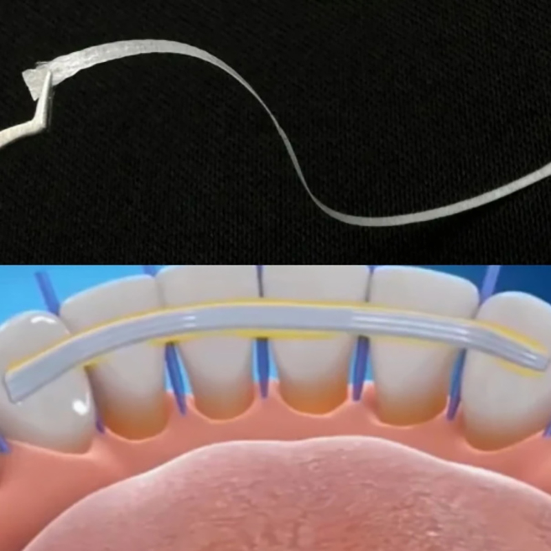 1/2/3/5 шт. стеклянные шинки д – обзор и цена Teeth Whitening Strips Crest
