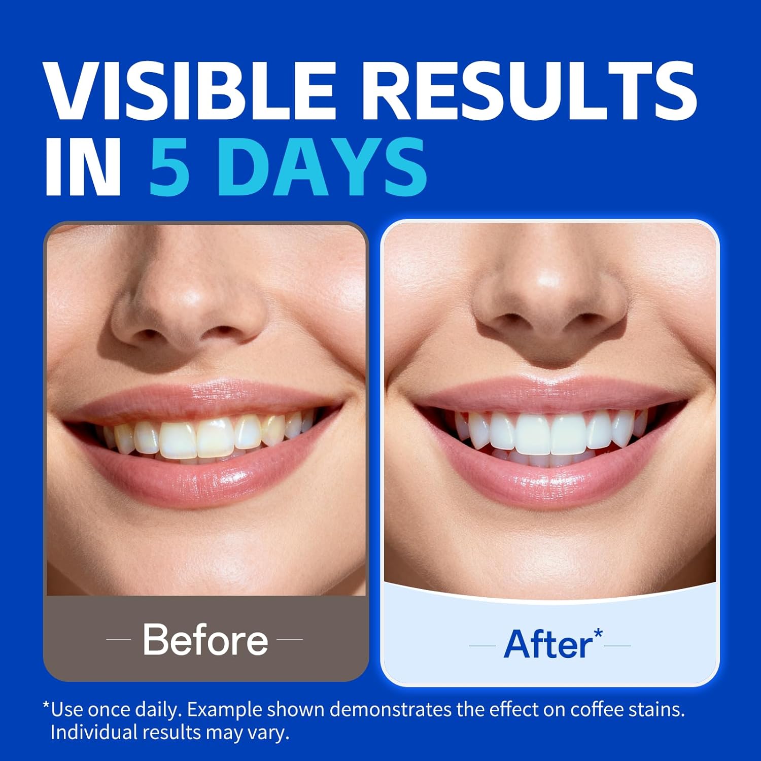 1/7 пары отбеливающих полосок  – обзор и цена Teeth Whitening Strips Crest