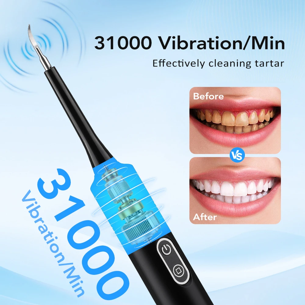 Электрический звуковой вибраци – обзор и цена Teeth Whitening Toothbrush