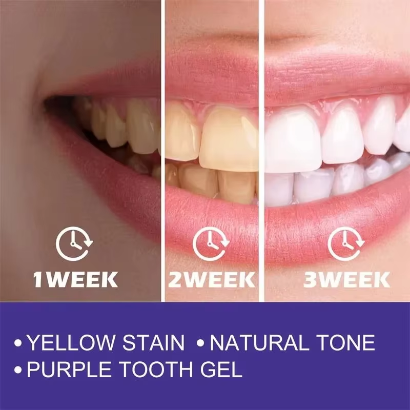 Очищение зубов, отбеливающая з – обзор и цена Teeth Whitening In Korea
